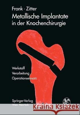 Metallische Implantate in Der Knochenchirurgie: Werkstoff - Verarbeitung, Operationseinsatz Frank, Erich 9783709182628 Springer