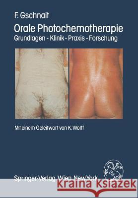 Orale Photochemotherapie: Grundlagen -- Klinik -- Praxis -- Forschung Wolff, K. 9783709186701 Springer