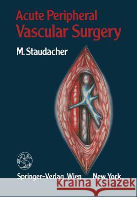 Acute Peripheral Vascular Surgery Michael Staudacher Wolfgang Rieder Ronald J. Stoney 9783709188040 Springer