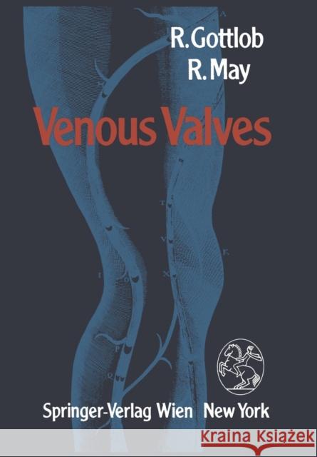 Venous Valves: Morphology, Function, Radiology, Surgery Gottlob, R. 9783709188293 Springer