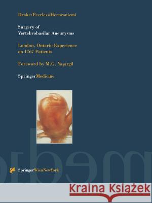 Surgery of Vertebrobasilar Aneurysms: London, Ontario Experience on 1767 Patients Yasargil, M. G. 9783709194119 Springer