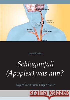 Schlaganfall (Apoplex), was nun?: Zögern kann fatale Folgen haben Duthel, Heinz 9783734796142 Books on Demand