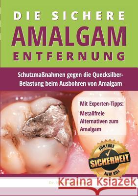 Die sichere Amalgam-Entfernung: Schutzmaßnahmen gegen die Quecksilber-Belastung beim Ausbohren von Amalgam Sauer, Hartmut 9783735763242 Books on Demand