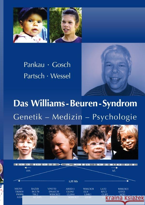 Das Williams-Beuren-Syndrom Pankau, Rainer, Gosch, Angela, Wessel, Armin 9783737543002 epubli