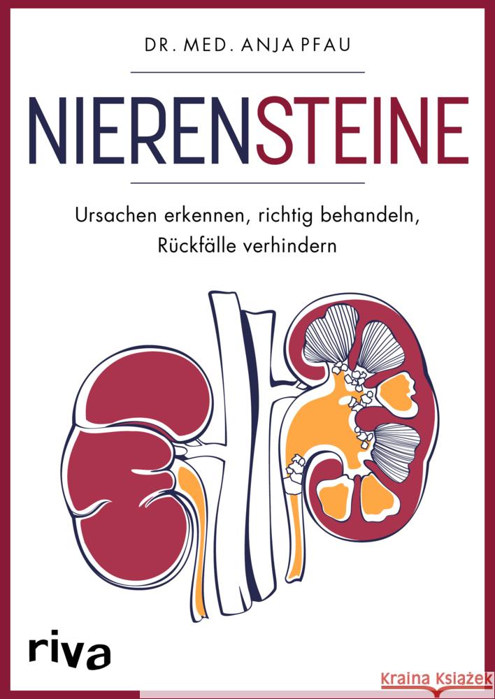 Nierensteine - Ursachen erkennen, richtig behandeln, Rückfälle verhindern Pfau, Anja 9783742322685 Riva