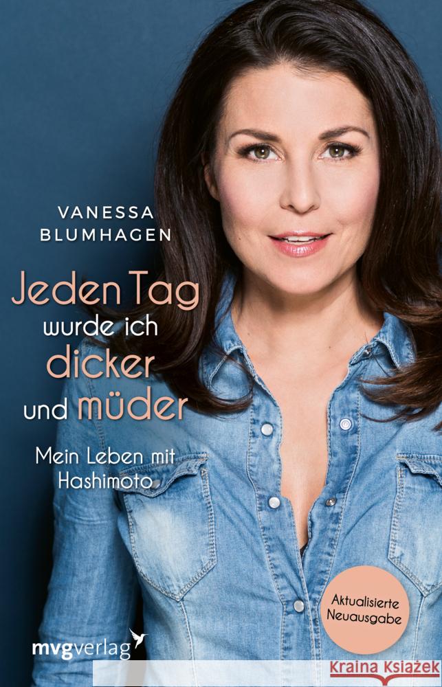 Jeden Tag wurde ich dicker und müder Blumhagen, Vanessa 9783747403709 mvg Verlag