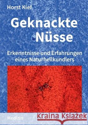 Geknackte Nüsse: Erkenntnisse und Erfahrungen eines Naturheilkundlers Kief, Horst 9783754302163