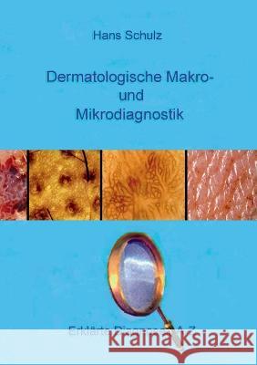 Dermatologische Makro- und Mikrodiagnostik: Erklärte Diagnosen A-Z Schulz, Hans 9783756823871 Books on Demand