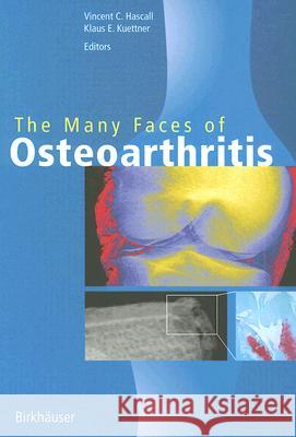 The Many Faces of Osteoarthritis Allan M. Krall V. C. Hascall K. E. Kuettner 9783764365813