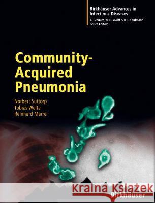 Community-Acquired Pneumonia Norbert Suttorp Tobias Welte Reinhard Marre 9783764375621 Birkhauser