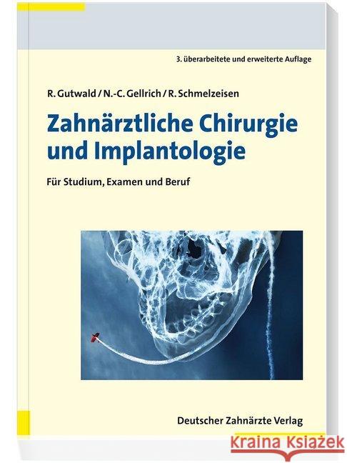 Zahnärztliche Chirurgie und Implantologie : Für Studium, Examen und Beruf Gutwald, Ralf; Gellrich, N.-C.; Schmelzeisen, Rainer 9783769136579