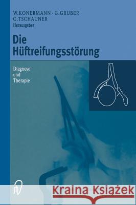 Die Hüftreifungsstörung: Diagnose Und Therapie Konermann, Werner 9783798511323 Steinkopff-Verlag Darmstadt