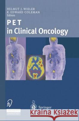 Pet in Clinical Oncology Helmut J. Wieler R. Edward Coleman H. J. Wieler 9783798512191 Springer