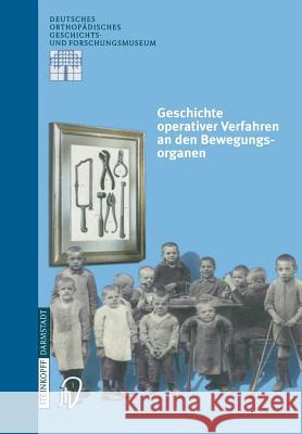 Geschichte Operativer Verfahren an Den Bewegungsorganen Zichner, L. 9783798512313 Steinkopff