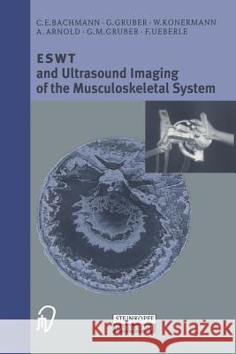 Eswt and Ultrasound Imaging of the Musculoskeletal System Bachmann, C. E. 9783798512528 Springer