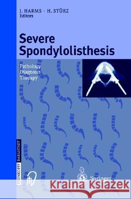Severe Spondylolisthesis: Pathology - Diagnosis - Therapy J. Harms H. Sturtz J. Harms 9783798512535 Steinkopff-Verlag Darmstadt