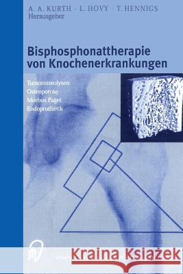 Bisphosphonattherapie Von Knochenerkrankungen: Tumorosteolysen Osteoporose M. Paget Endoprothetik Kurth, A. A. 9783798512665 Steinkopff-Verlag Darmstadt