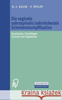 Die Vaginale Sakrospinale/Sakrotuberale Scheidenstumpffixation: Geschichte, Grundlagen, Technik Und Ergebnisse Kaum, H. -J 9783798513440 Steinkopff-Verlag Darmstadt