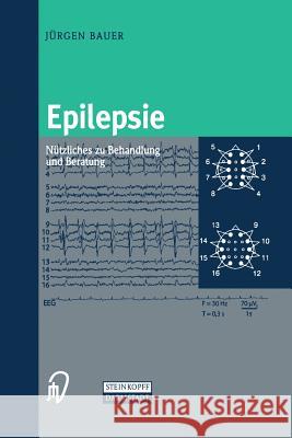 Epilepsie: Nützliches Zu Behandlung Und Beratung Bauer, Jürgen 9783798513570 Steinkopff