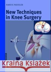 New Techniques in Knee Surgery Paessler                                 H. H. Paessler Hans H. Paessler 9783798513877 Springer