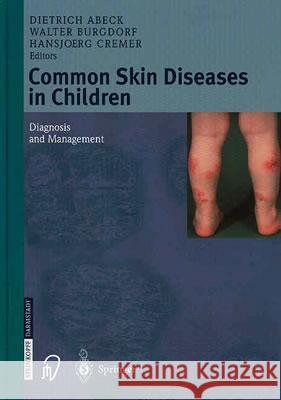 Common Skin Diseases in Children: Diagnosis and Management Dietrich Abeck Walter Burgdorf Hansjoerg Cremer 9783798513891