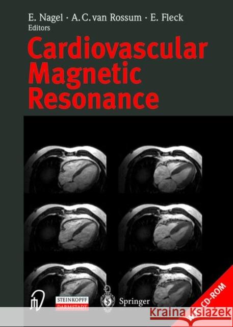 Cardiovascular Magnetic Resonance [With CDROM] E. Nagel A. C. Va E. Fleck 9783798514027 Springer