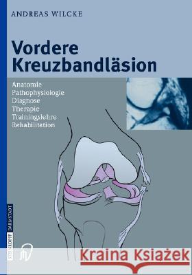 Vordere Kreuzbandläsion: Anatomie Pathophysiologie Diagnose Therapie Trainingslehre Rehabilitation Wilcke, Andreas 9783798514041 Springer