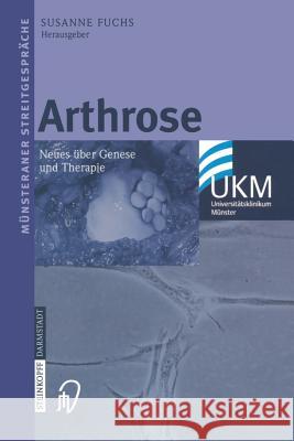 Arthrose: Neues Über Genese Und Therapie Fuchs, Susanne 9783798514577 Steinkopff