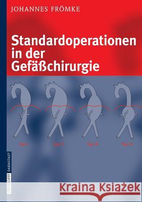 Standardoperationen in der Gefäßchirurgie Johannes Frömke 9783798514607 Steinkopff Darmstadt