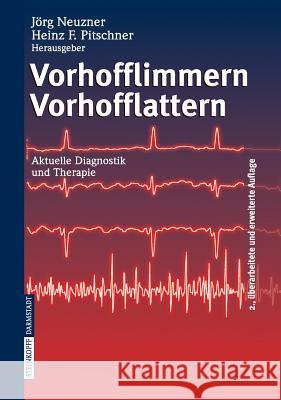 Vorhofflimmern Vorhofflattern: Aktuelle Diagnostik Und Therapie Neuzner, J. 9783798515062 Steinkopff