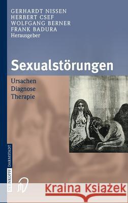 Sexualstörungen: Ursachen Diagnose Therapie Nissen, G. 9783798515475 Steinkopff-Verlag Darmstadt