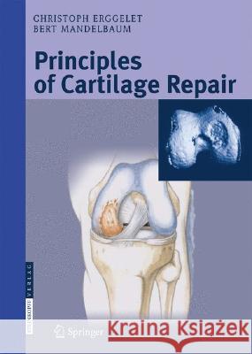 Principles of Cartilage Repair Christoph Erggelet Bert R. Mandelbaum 9783798515901 STEINKOPFF DARMSTADT,GERMANY