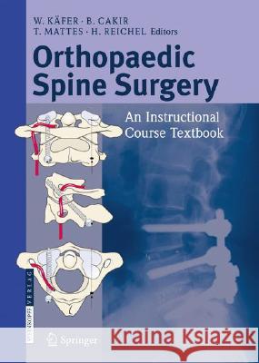 Orthopaedic Spine Surgery: - An Instructional Course Textbook Käfer, W. 9783798518285 STEINKOPFF DARMSTADT,GERMANY