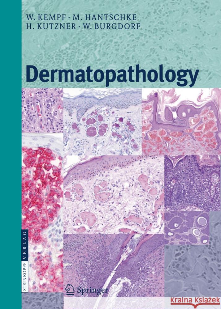 Dermatopathology Kempf, Werner, Hantschke, Markus, Kutzner, Heinz 9783798518391