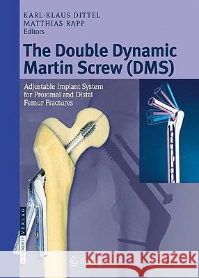 The Double Dynamic Martin Screw (DMS): Adjustable Implant System for Proximal and Distal Femur Fractures Dittel, Karl-Klaus 9783798518414 Steinkopff-Verlag Darmstadt