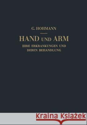 Hand Und Arm: Ihre Erkrankungen Und Deren Behandlung Hohmann, Georg 9783807002248