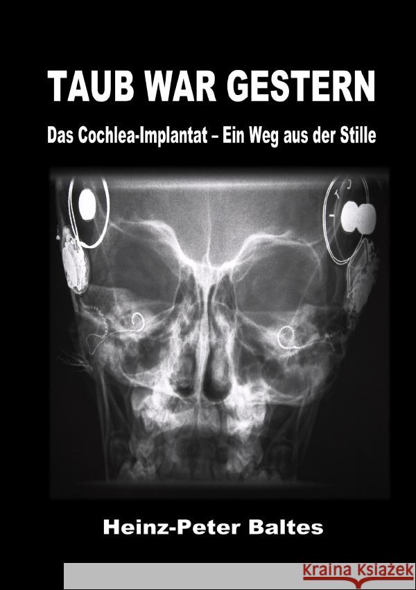 Taub war gestern Baltes, Heinz-Peter 9783819030956