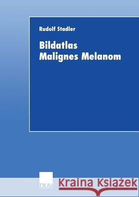 Bildatlas Malignes Melanom Rudolf Stadler 9783824421459 Springer