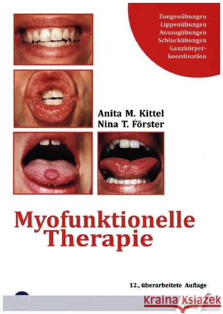 Myofunktionelle Therapie Kittel, Anita; Förster, Nina T. 9783824812721 Schulz-Kirchner