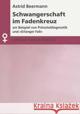 Schwangerschaft Im Fadenkreuz: Am Beispiel Von Pränataldiagnostik Und Erlanger Fall Beermann, Astrid 9783825500818 Centaurus Verlag & Media