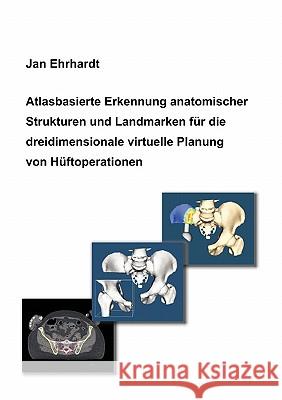 Atlasbasierte Erkennung anatomischer Strukturen und Landmarken für die dreidimensionale virtuelle Planung von Hüftoperationen Jan Ehrhardt 9783833422904 Books on Demand