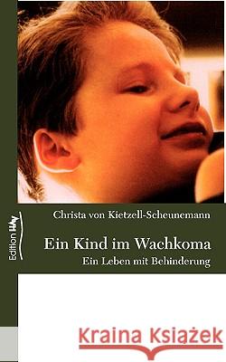 Ein Kind im Wachkoma: Ein Leben mit Behinderung Kietzell-Scheunemann, Christa Von 9783833449017 Bod