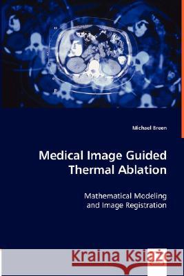 Medical Image Guided Thermal Ablation Michael Breen 9783836468800 VDM Verlag
