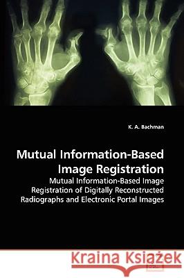 Mutual Information-Based Image Registration K A Bachman 9783836484831 VDM Verlag