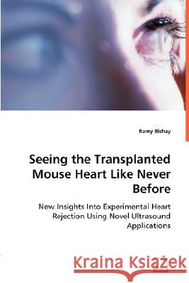 Seeing the Transplanted Mouse Heart Like Never Before Ramy Bishay 9783836487382 VDM Verlag