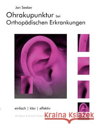 Ohrakupunktur bei Orthopädischen Erkrankungen: Balancierte Ohrakupunktur: einfach, klar, effektiv Seeber, Jan 9783837027815 Books on Demand