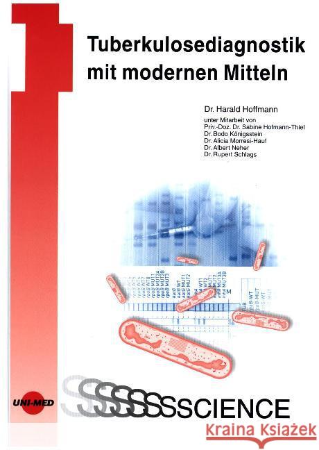 Tuberkulosediagnostik mit modernen Mitteln Hoffmann, Harald 9783837413519