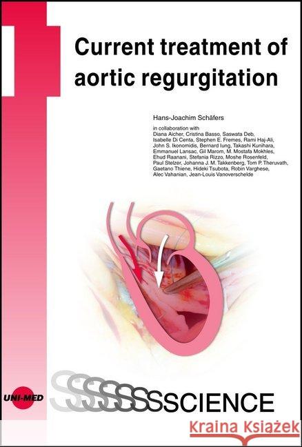 Current treatment of aortic regurgitation Schäfers, Hans-Joachim 9783837414066 UNI-MED, Bremen