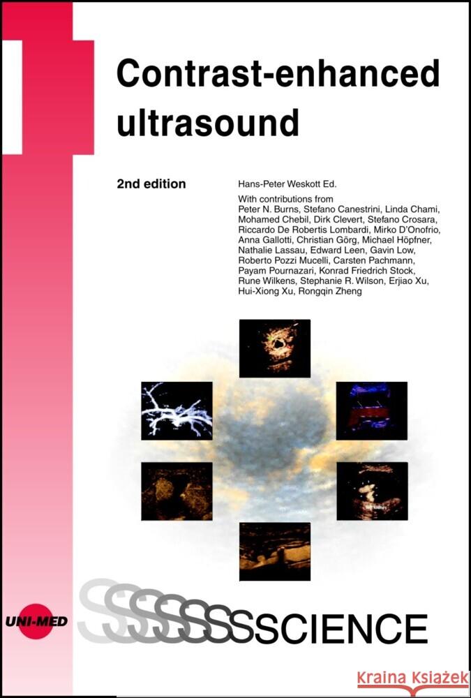 Contrast-enhanced ultrasound Weskott, Hans-Peter 9783837414288 UNI-MED, Bremen