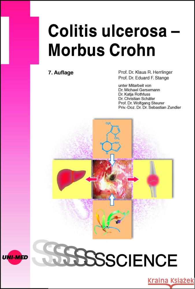 Colitis ulcerosa - Morbus Crohn Herrlinger, Klaus R., Stange, Eduard F. 9783837416428 UNI-MED, Bremen